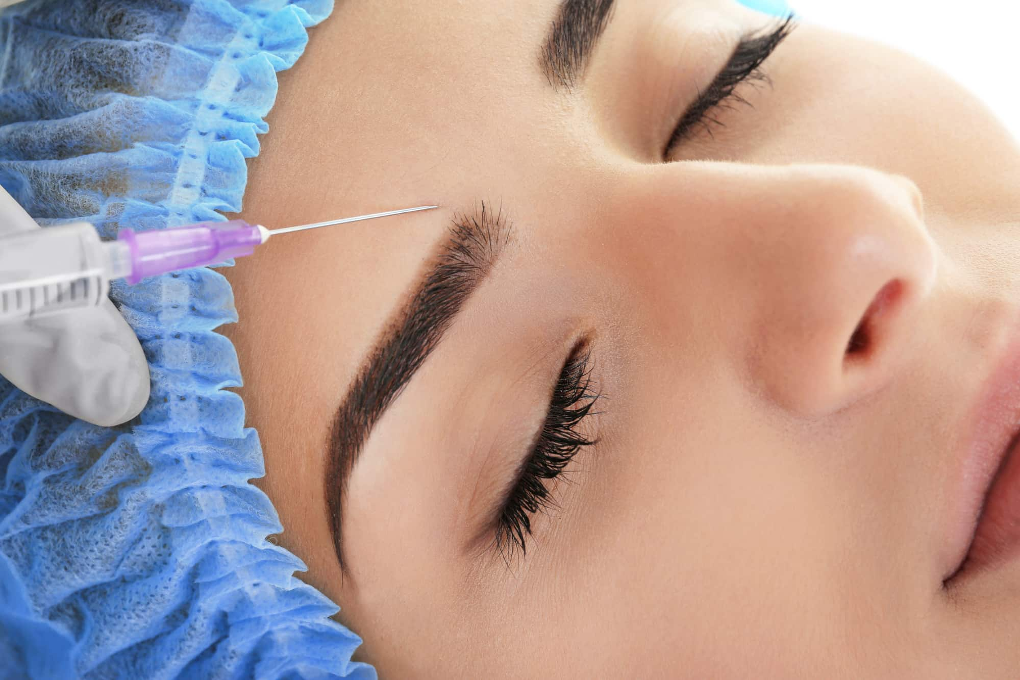 injection into the eyebrow area