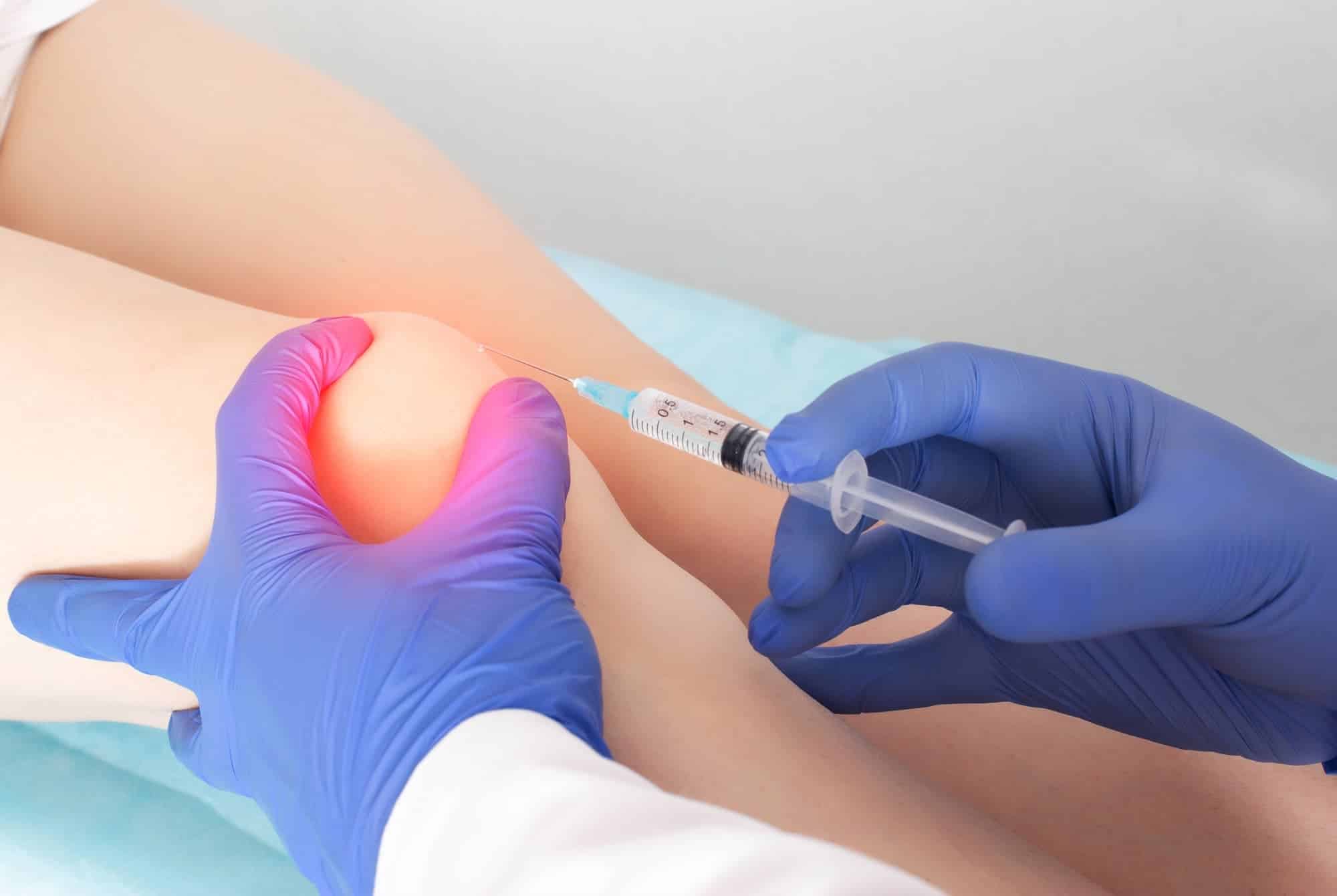 doctor injecting a patient's knee