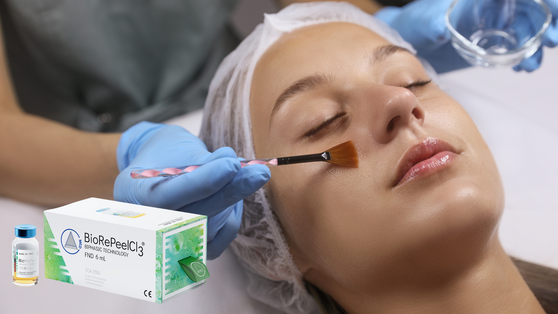 An individual undergoes a chemical peeling procedure; Biorepeel FND can address various skin concerns.