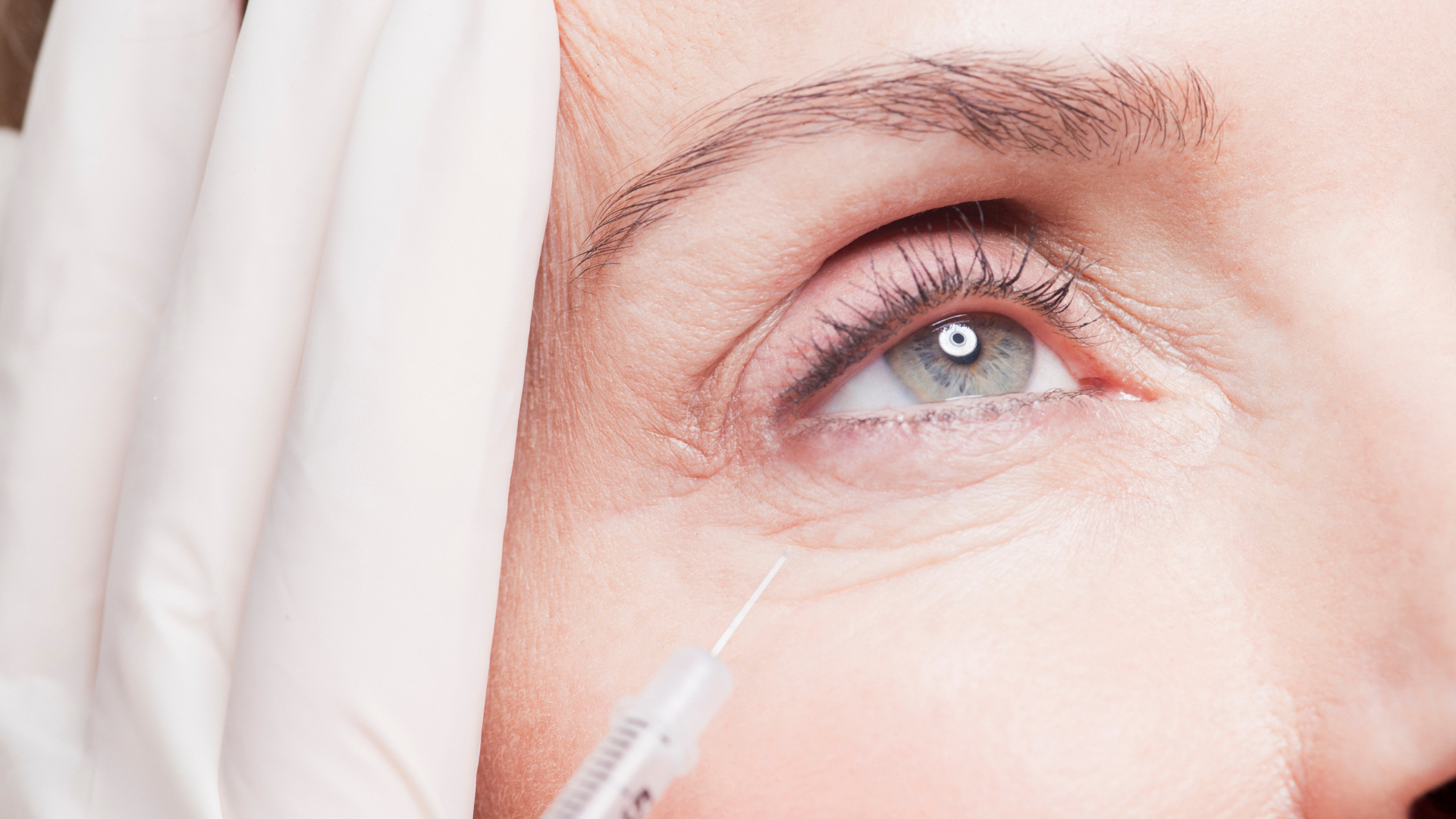 A qualified provider injecting Botox into the patient's facial skin.