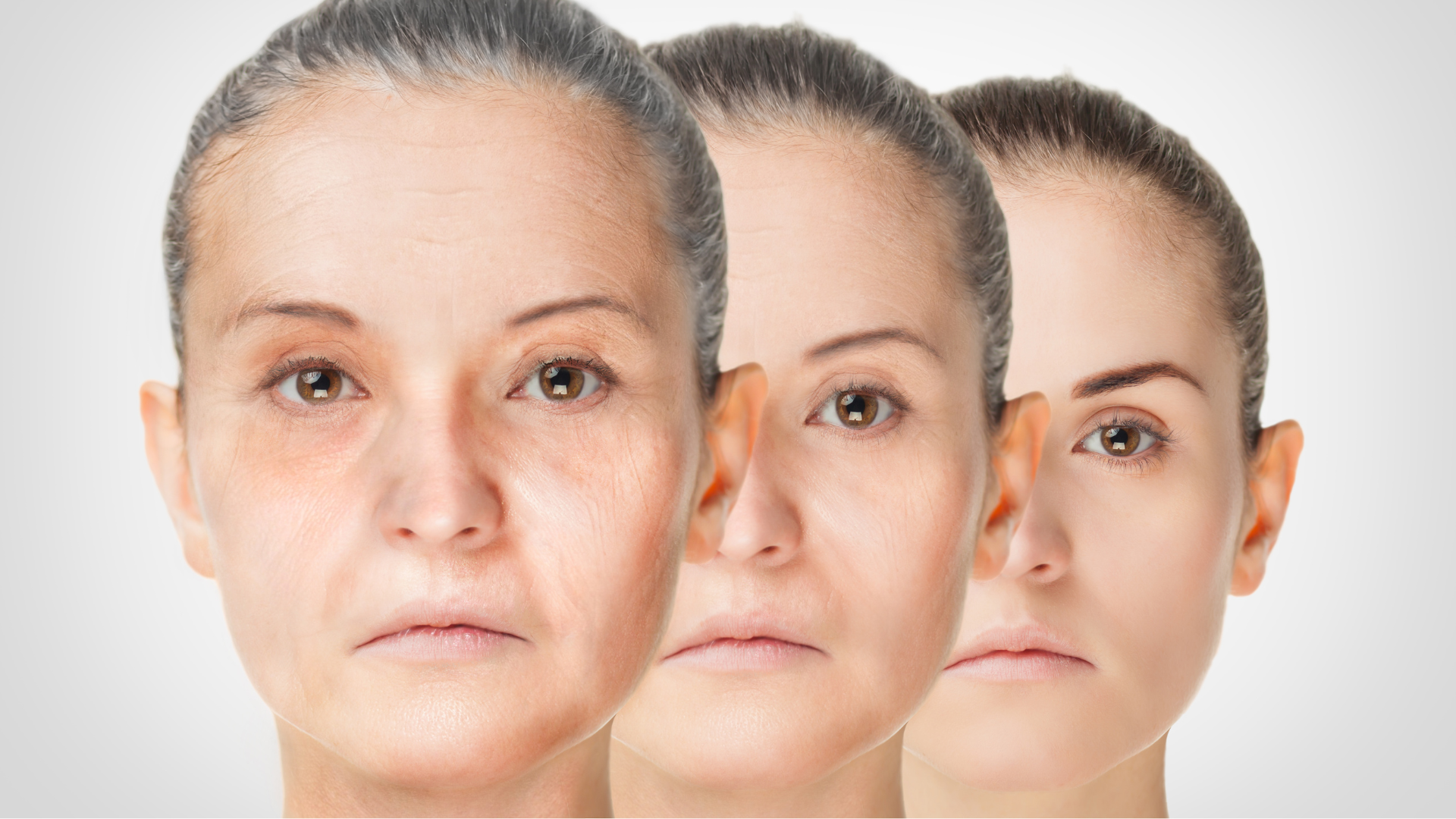 The aging process of individuals that affect their facial skin.