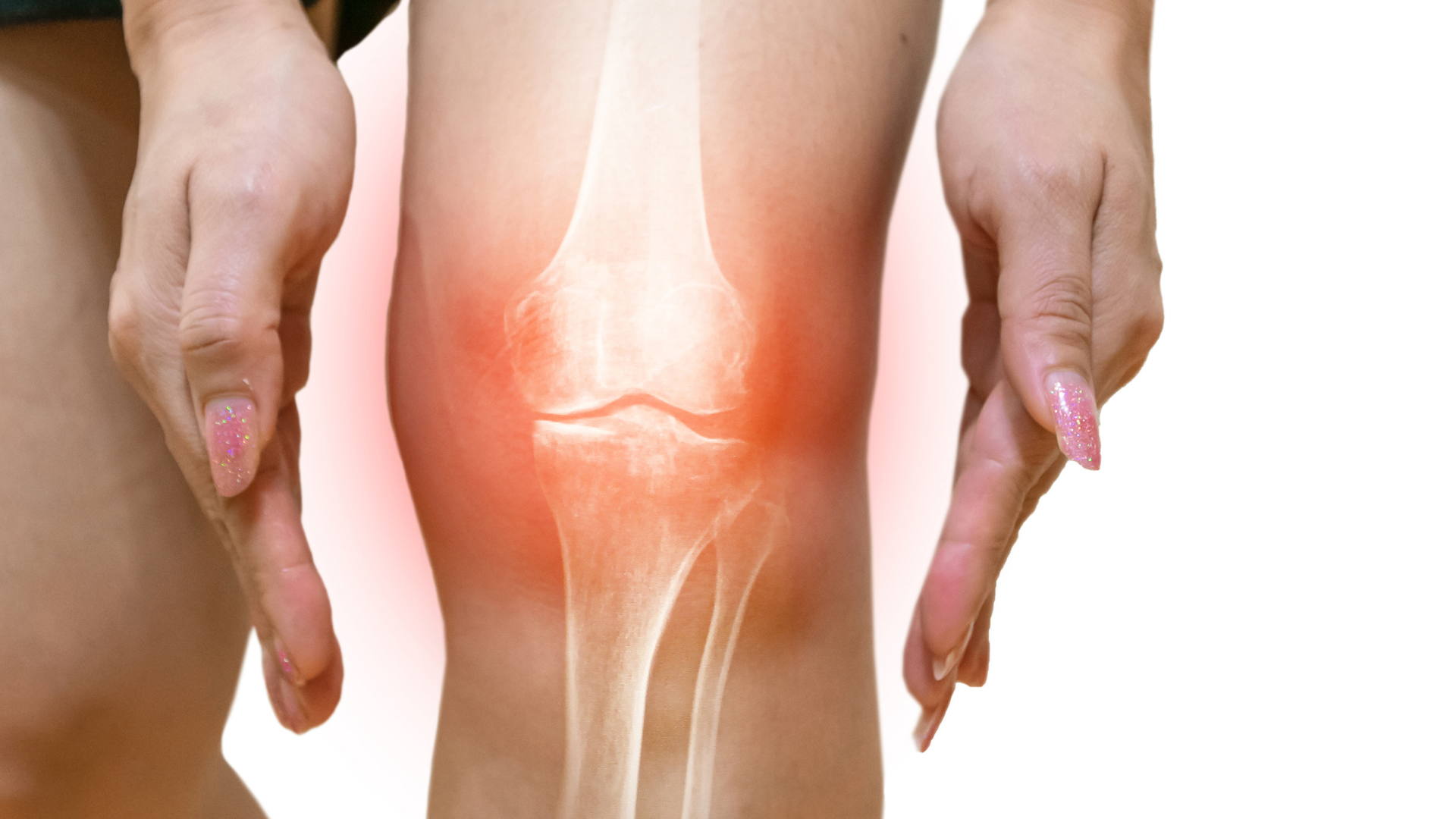 An individual suffering from knee pain and inflammation.