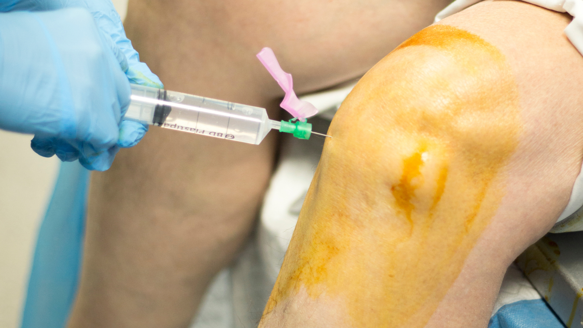 A healthcare provider administering an injection into the patient's knee.