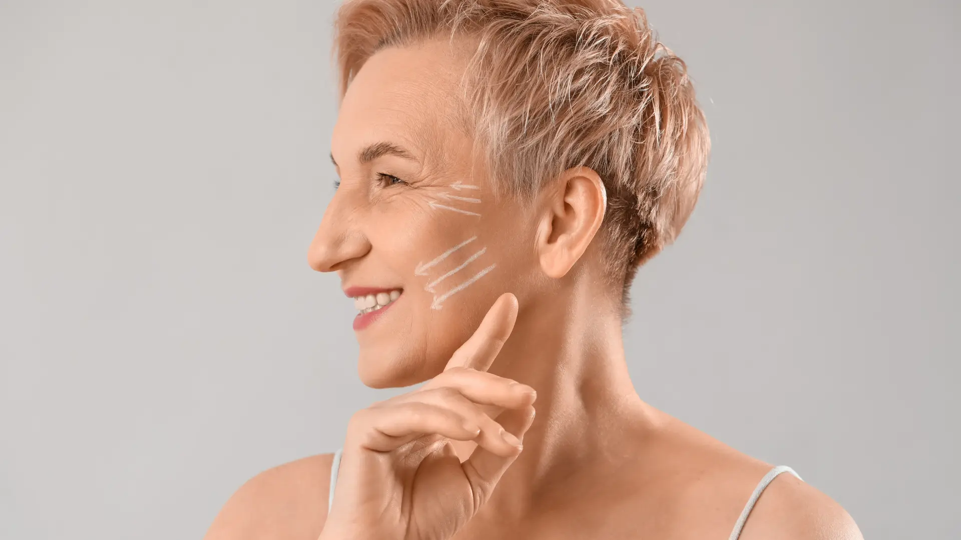 An individual showing off their facial signs of aging that requires an injection treatment.