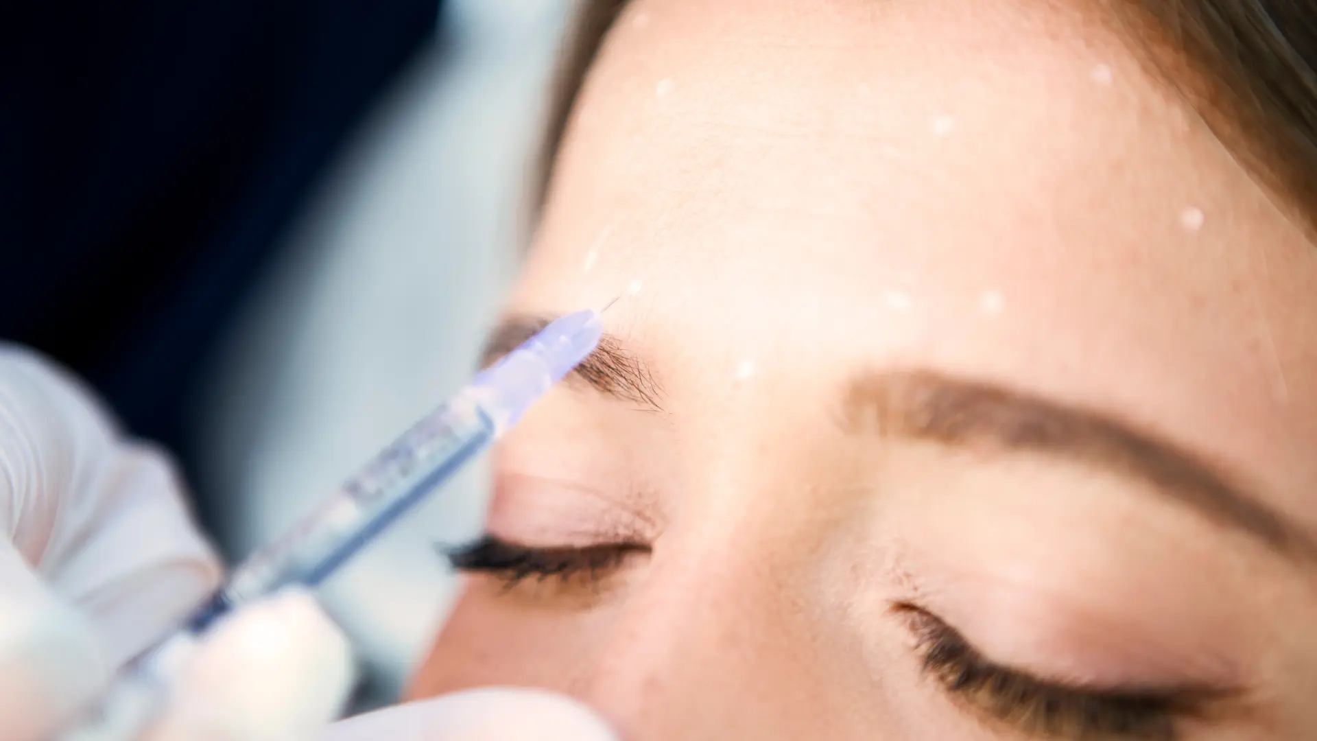 A medical professional administering an injection into the patient's glabella lines.