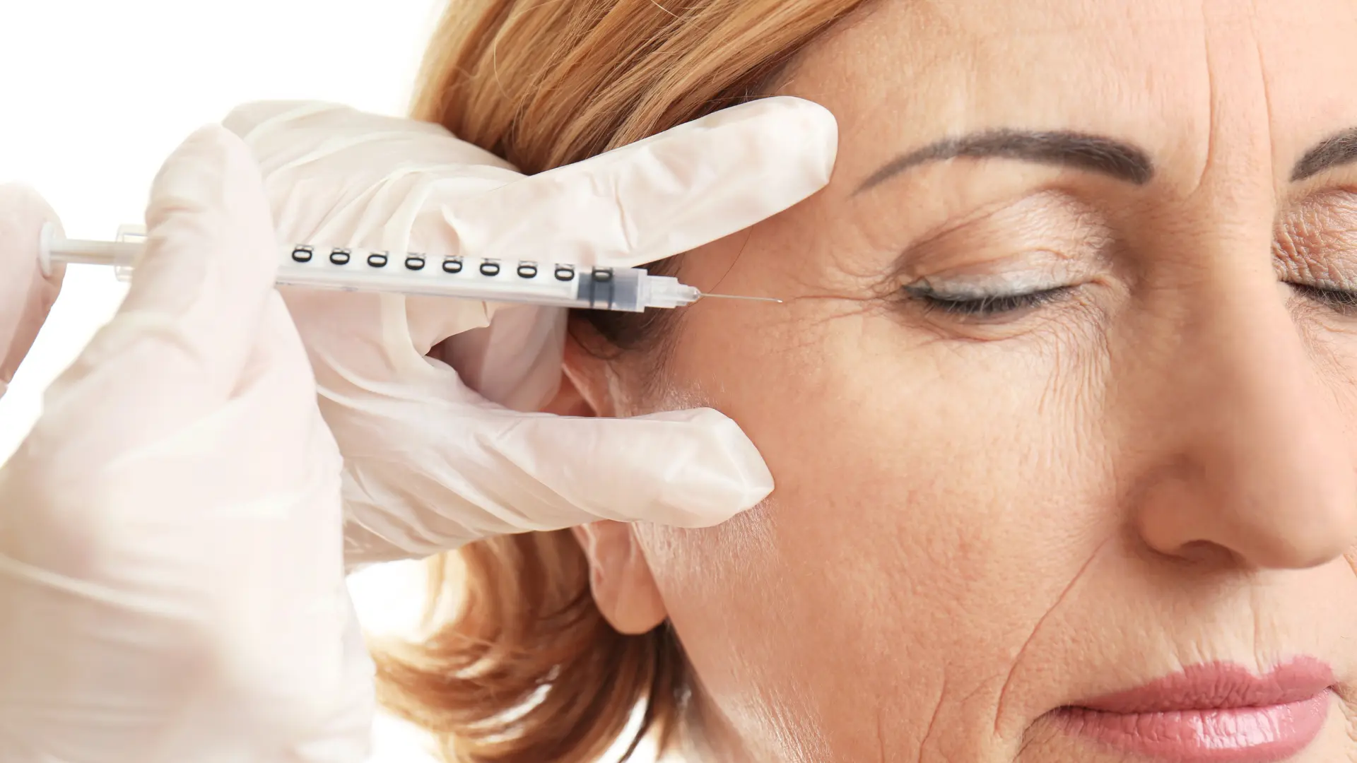 A healthcare professional administering an injection for the crow's feet.