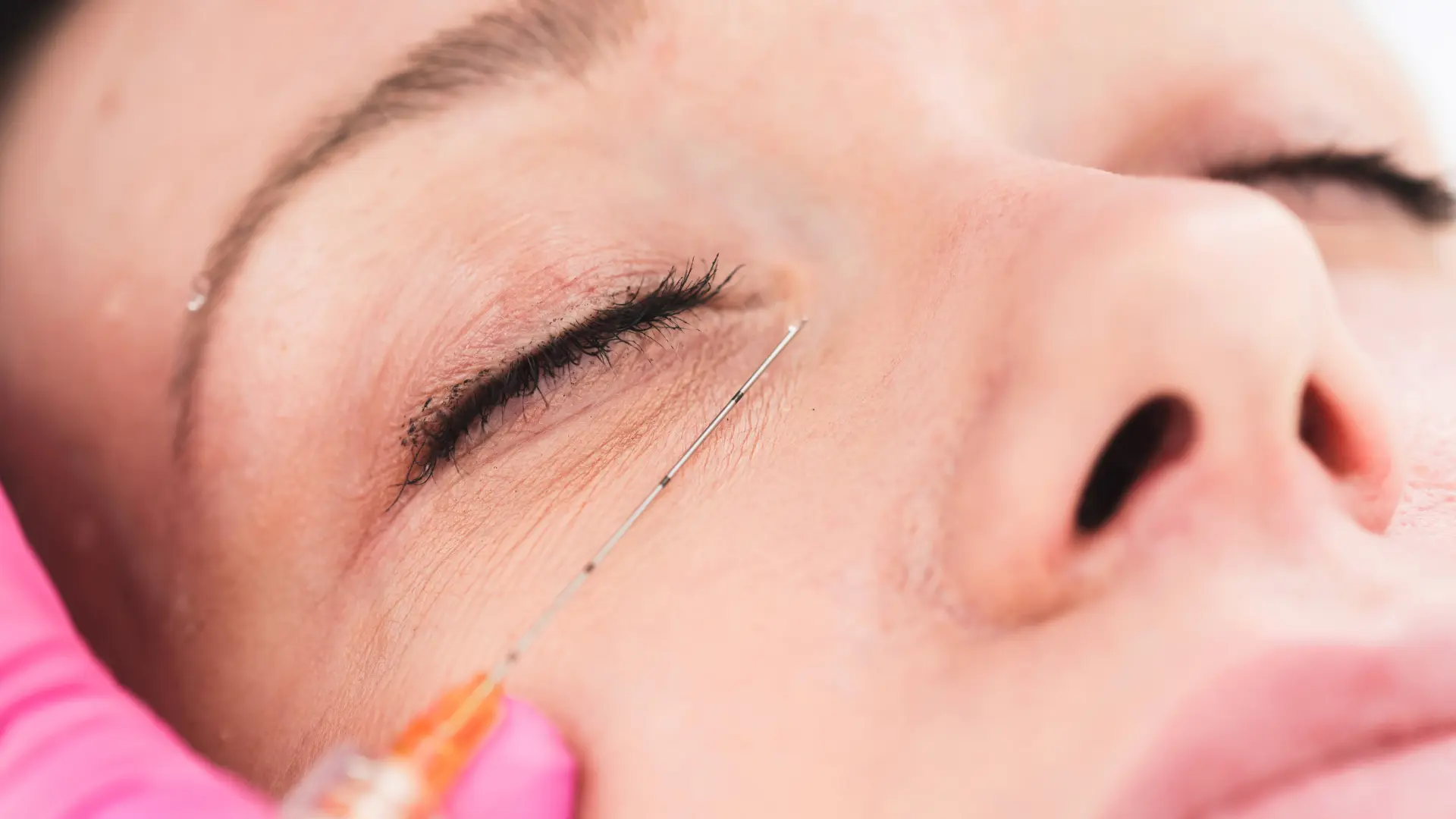 A medical professional administering a tear trough injection treatment.