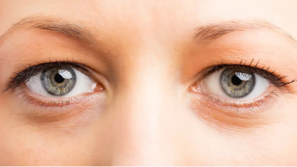 A close-up shot of a patient's eyes.