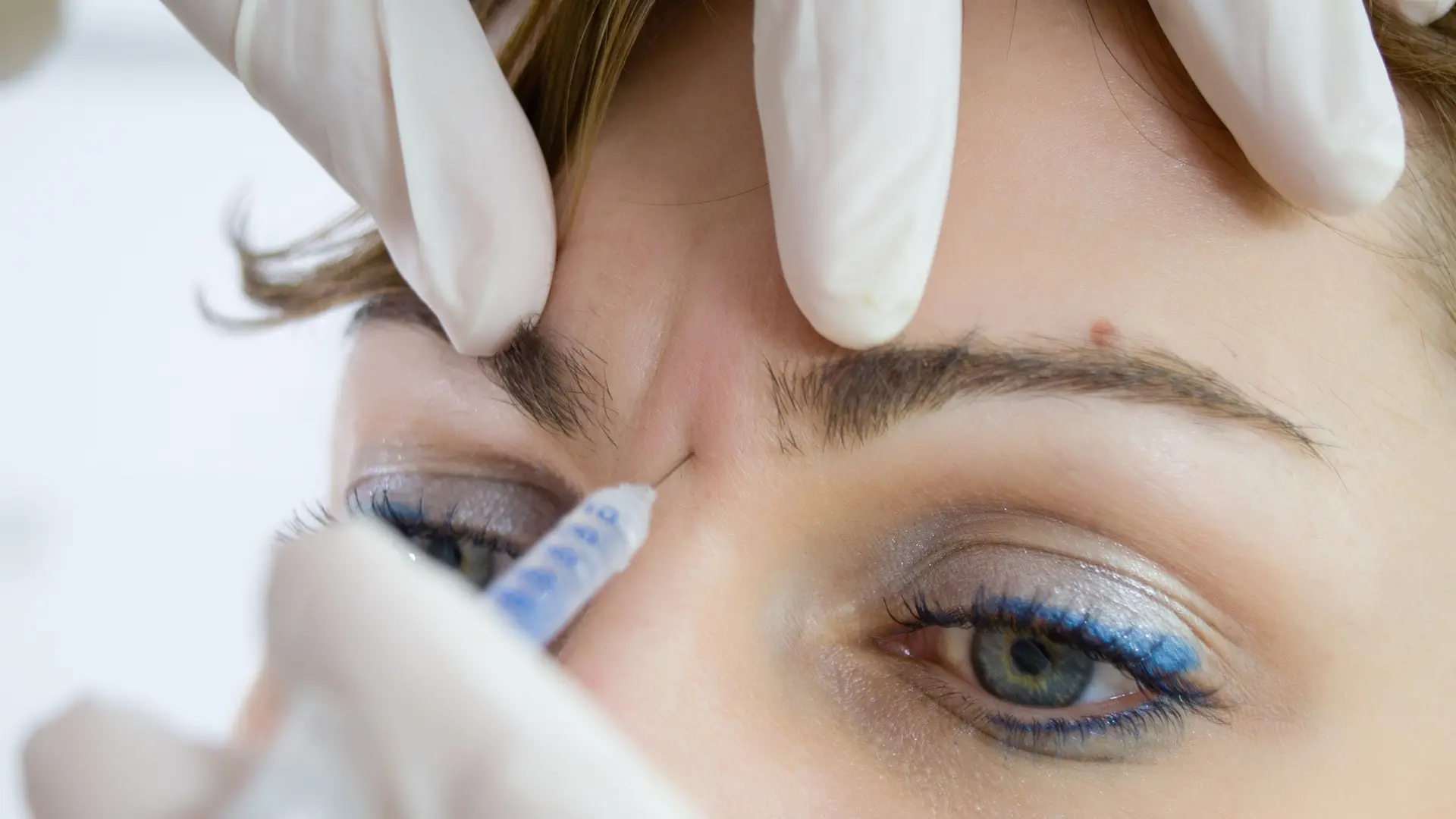 A healthcare provider administering an injection for the frown lines.