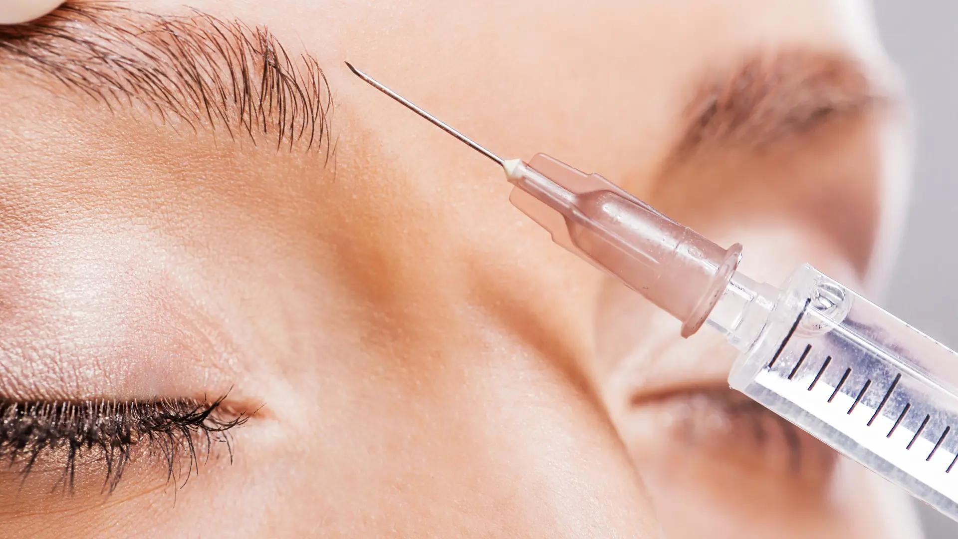 A close-up shot of an injection into a patient's brow area.