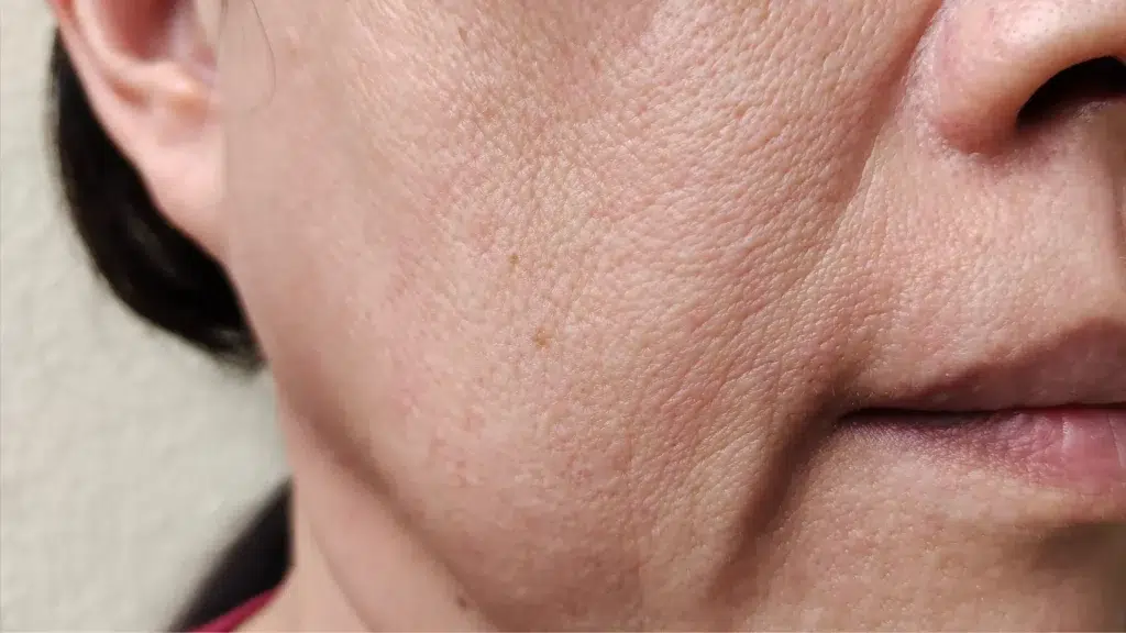 An older individual's sagging jowls area.