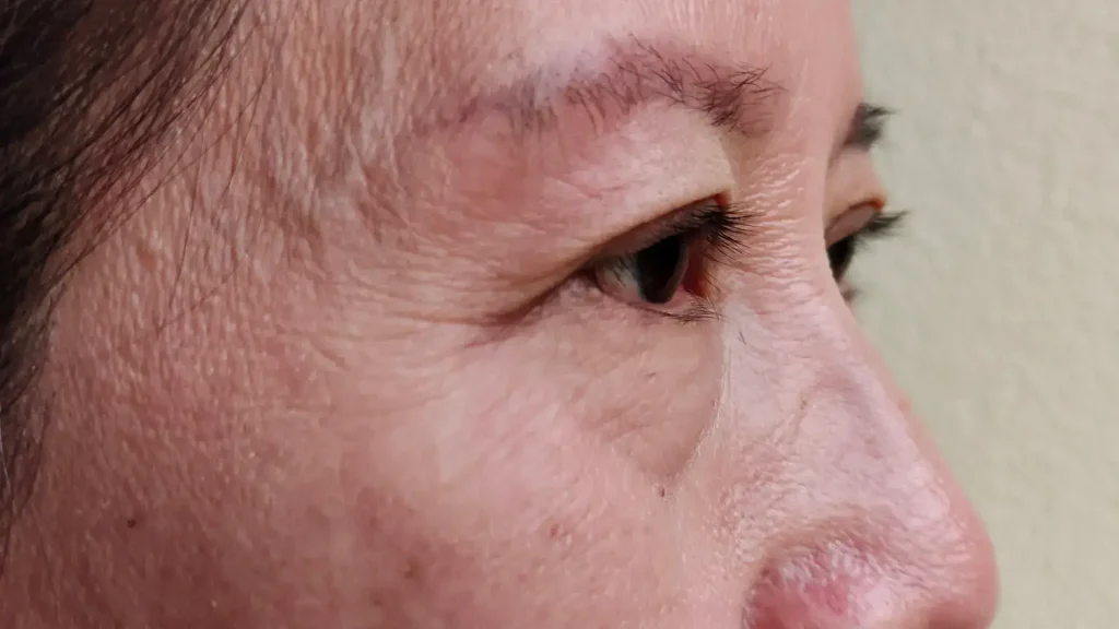 An older individual's close-up shot of their eye area.